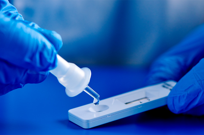 Inmunocromatografía: la revolución silenciosa en el diagnóstico rápido